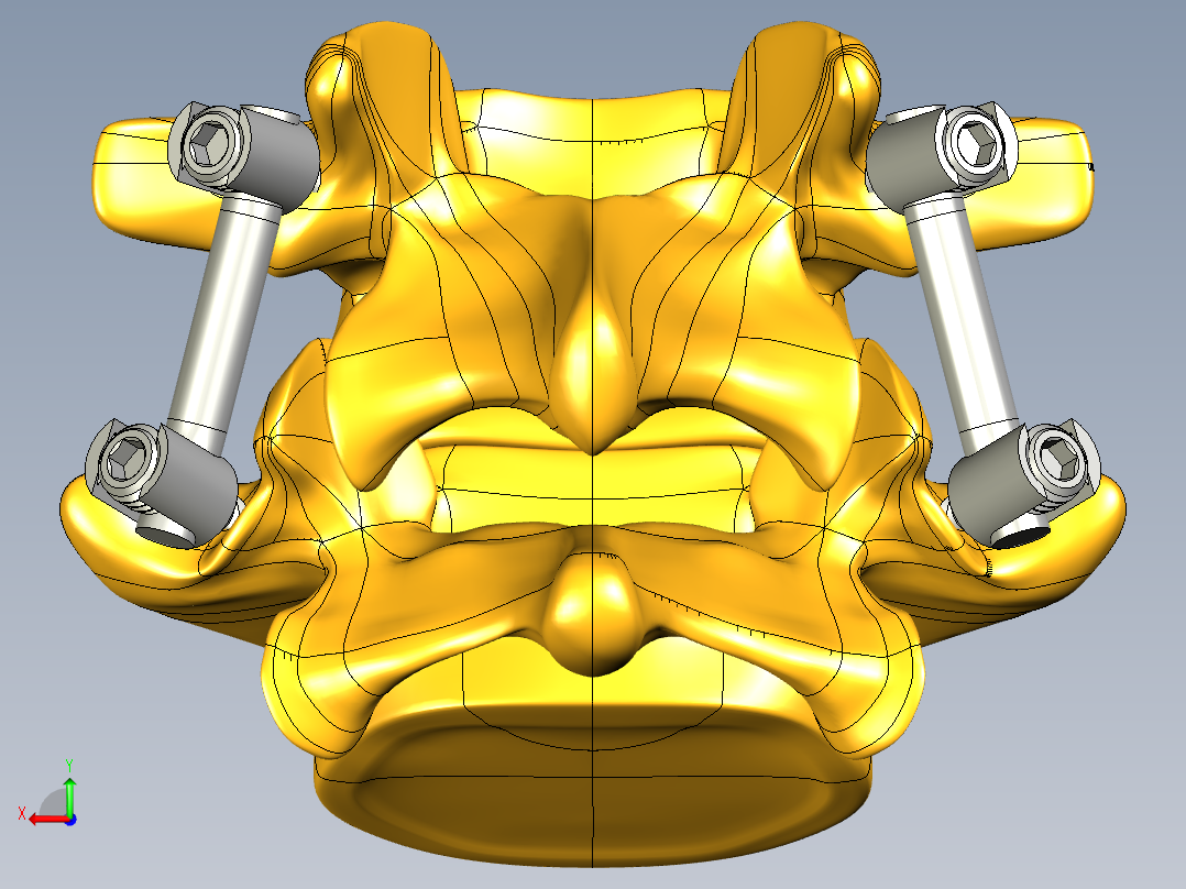 椎弓根螺钉系统后视图