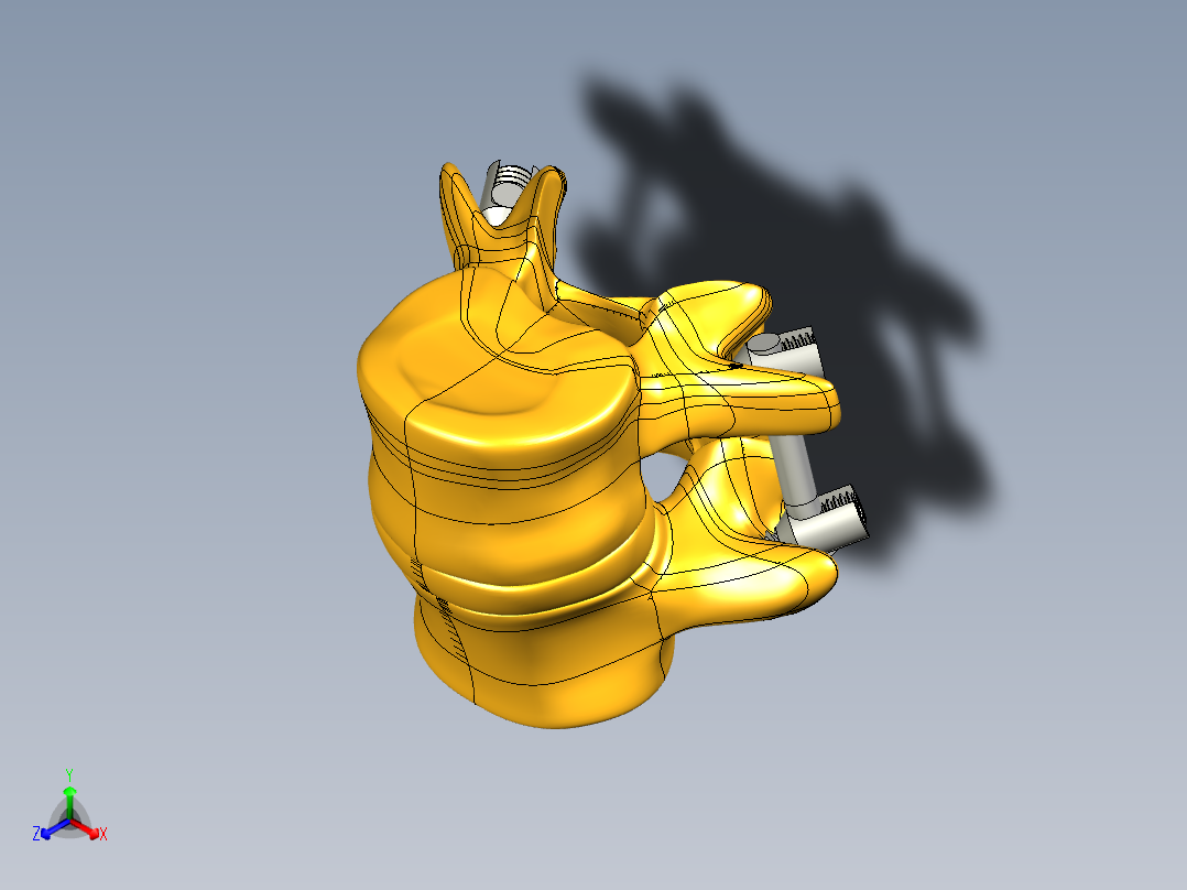 椎弓根螺钉系统正等轴测图